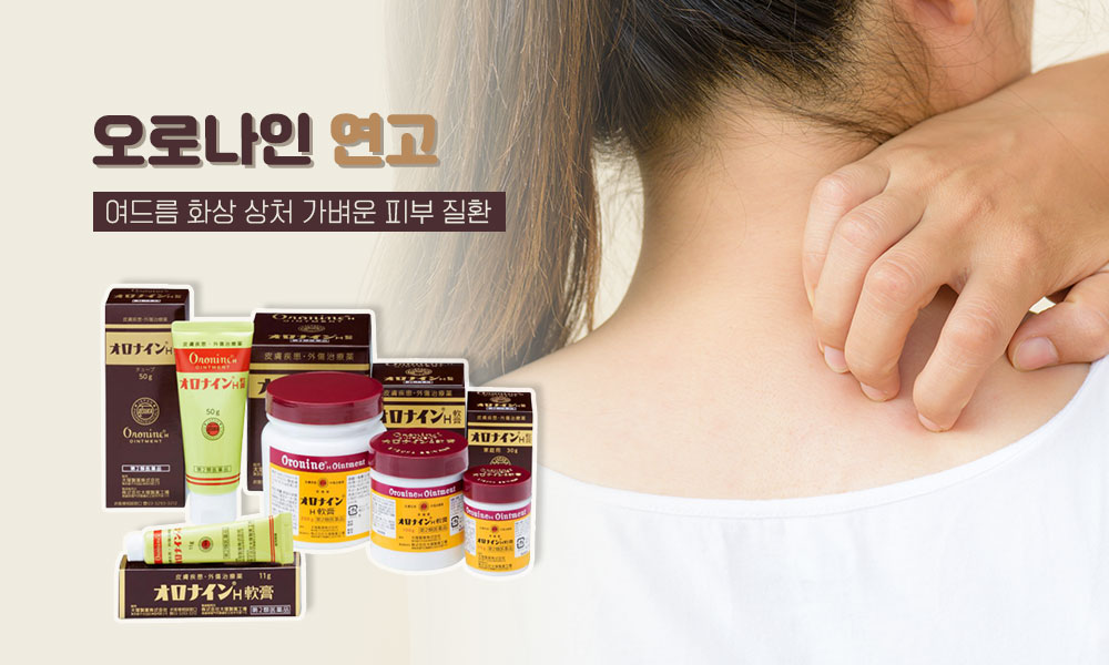 오로나인연고 1000x600 1